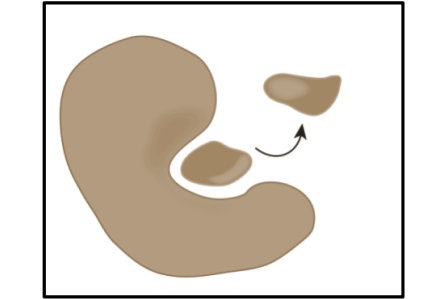 Enzyme catalysis.png
